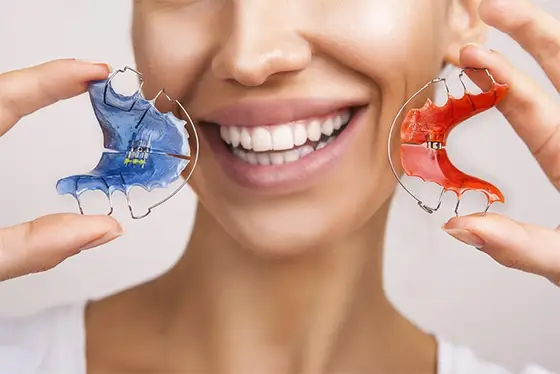 Orthodontic treatment at Hyderabad Dental